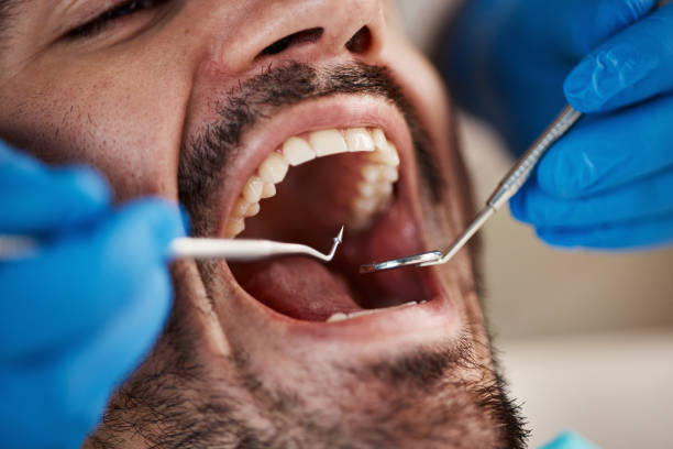 Best Full Mouth Reconstruction  in Los Chaves, NM